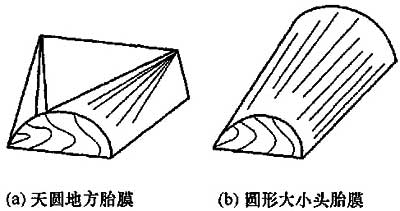 图4 异形胎膜示意